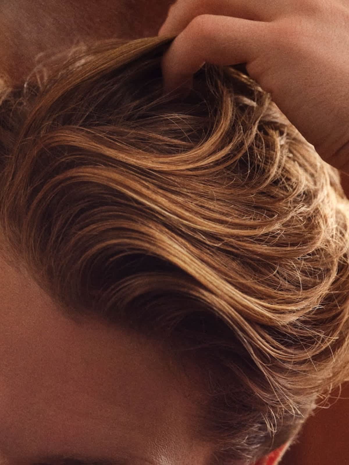 8 Autoimmune Diseases That Cause Hair Loss