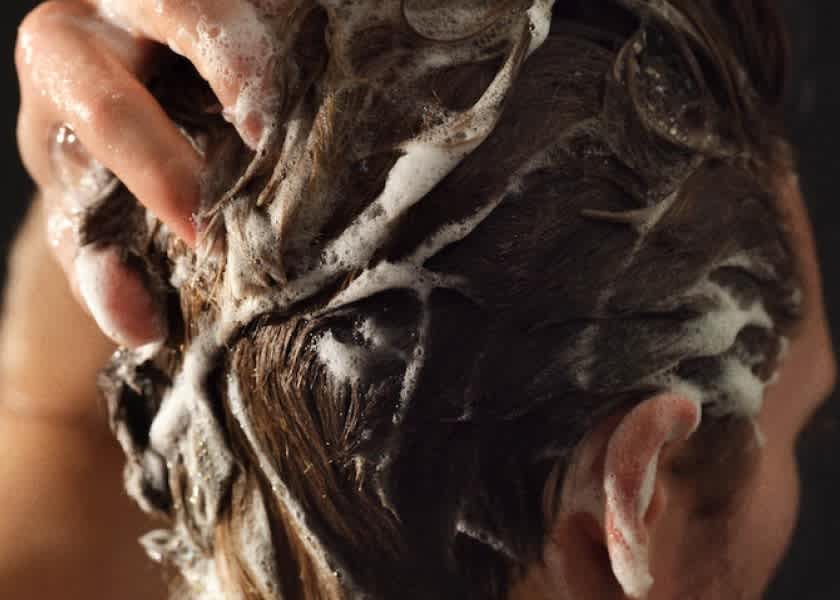 Why Do Men Go Bald? 7 Reasons You Might Be Losing Hair
