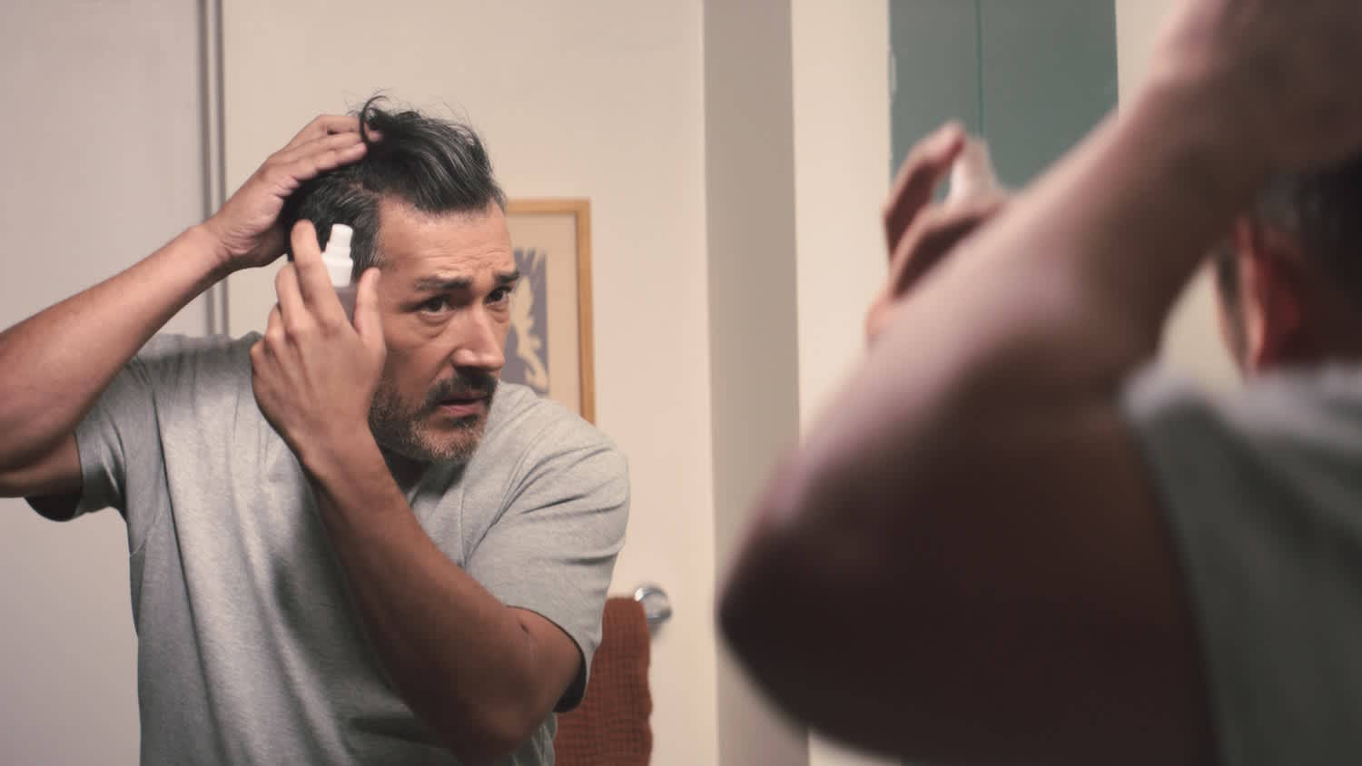 Mature Hairline: Causes & Treatment Options