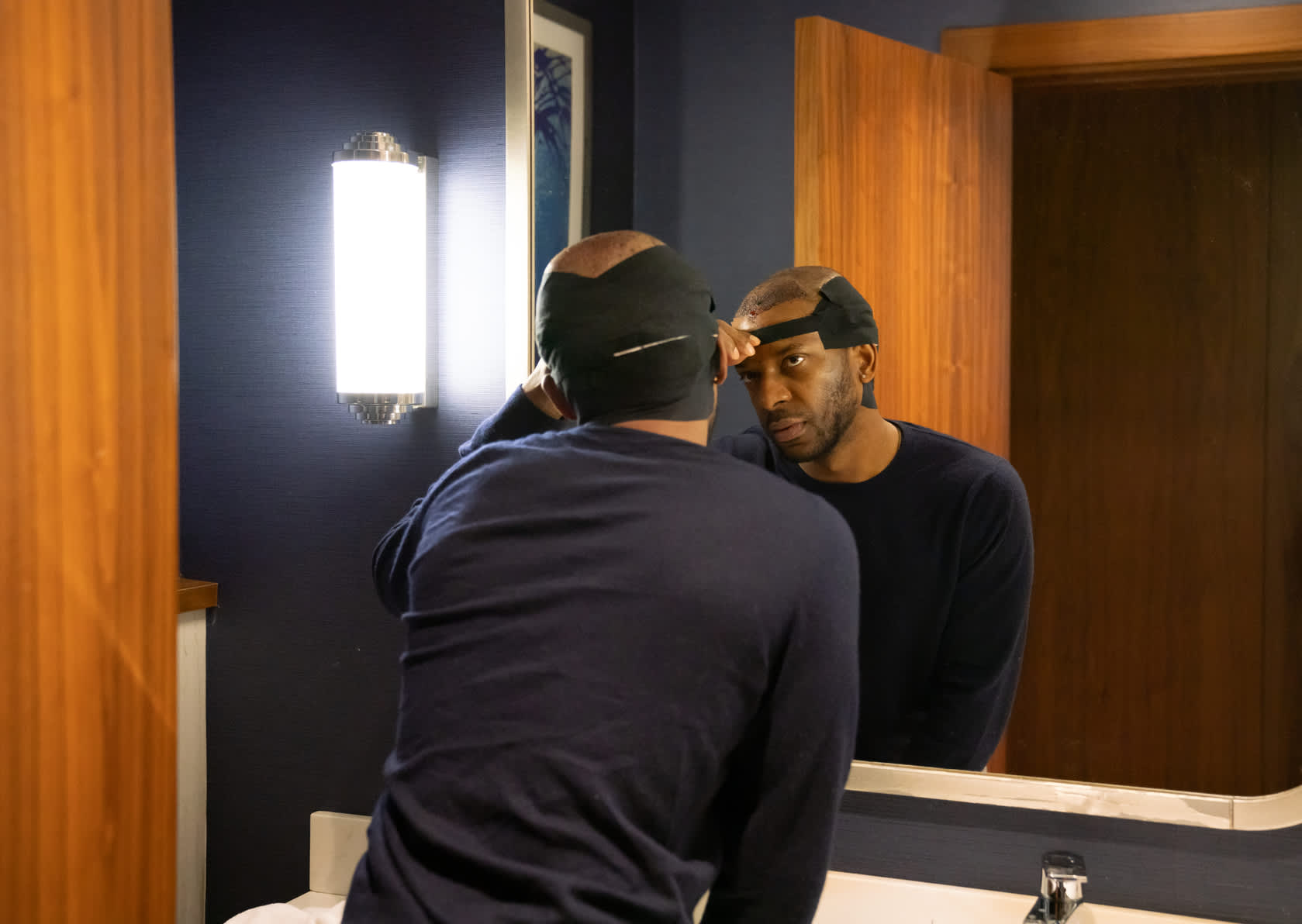 What’s the Latest Hair Transplant Technology?