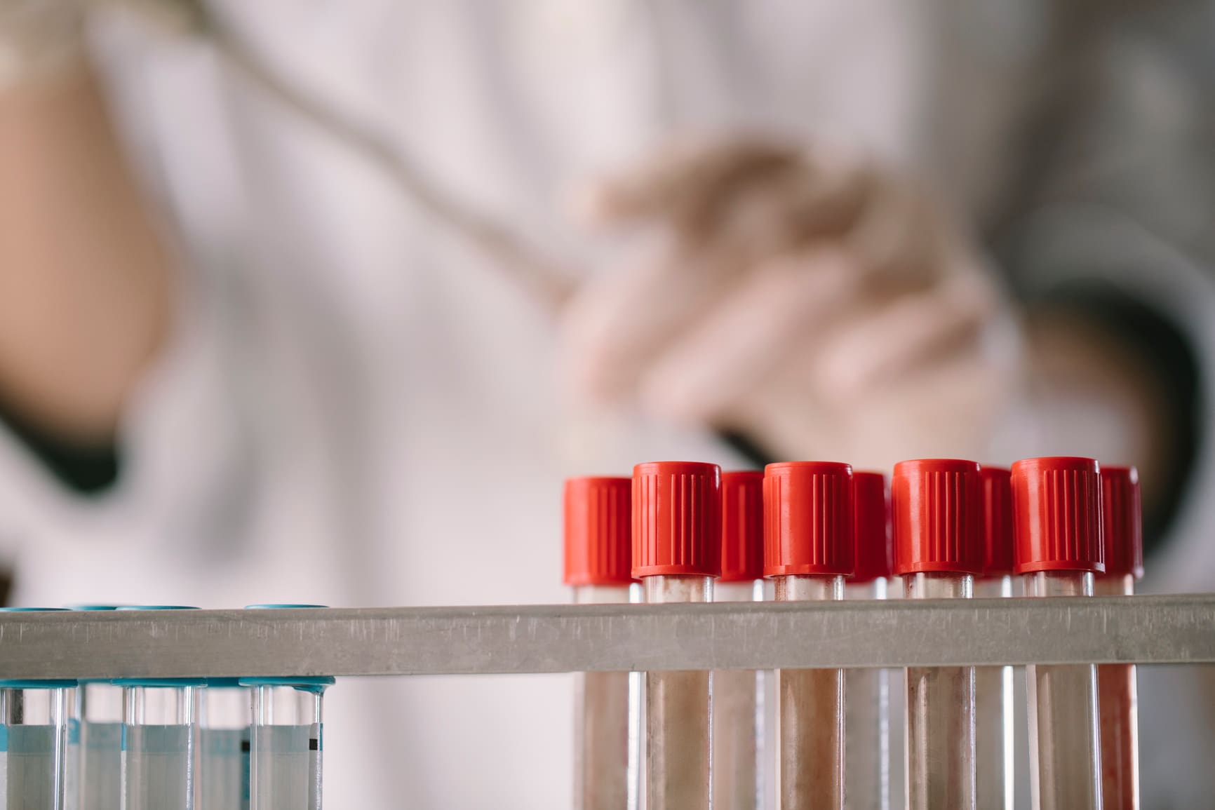 Functional vs. Conventional Blood Testing: Which Is Right for You?