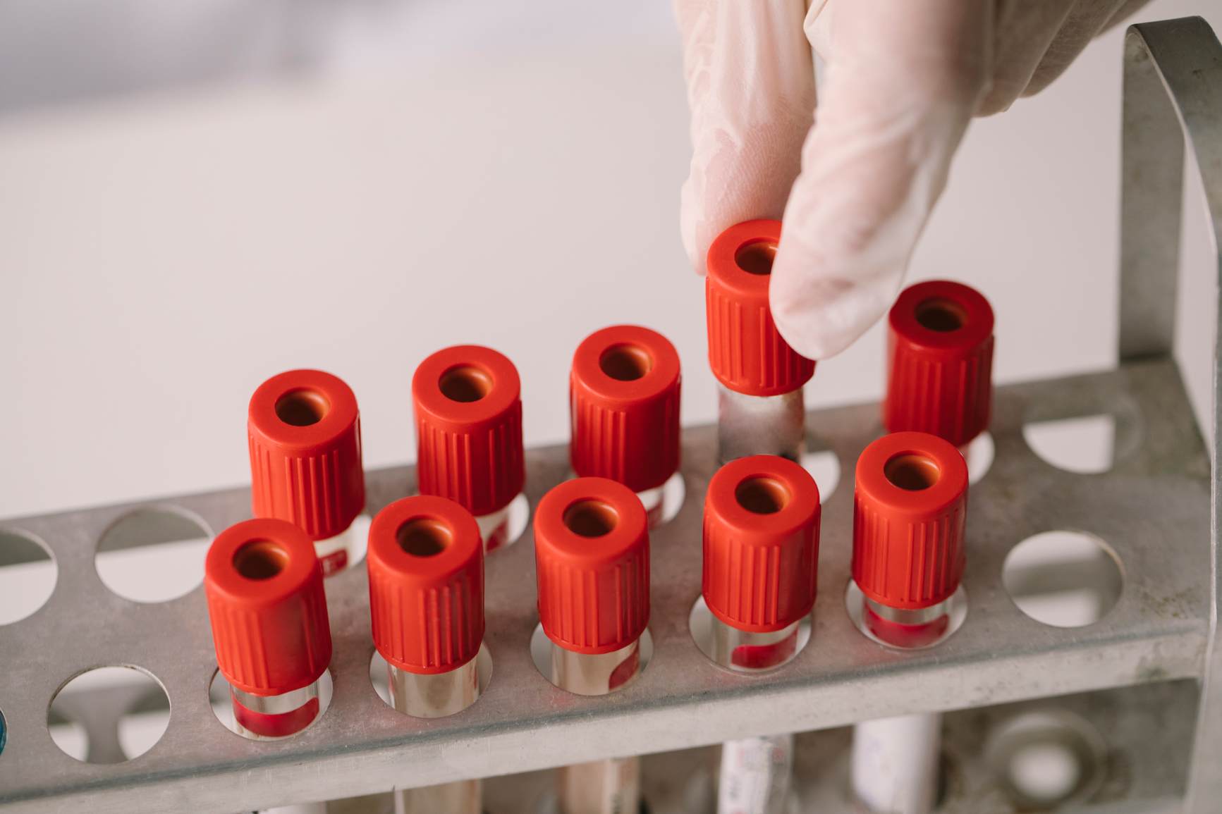 Understanding Blood Tests: How They Work and What They Can Tell You